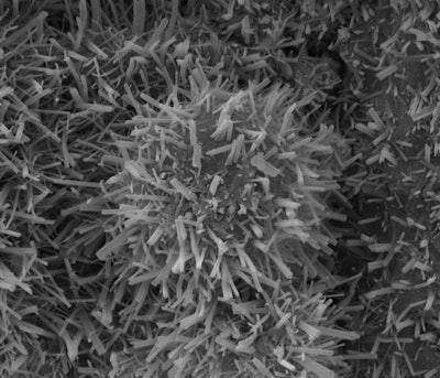 BescherBalls (self-organized structures) are very small -- 20 to 100 microns in size -- and can only be seen clearly under an electron microscope.