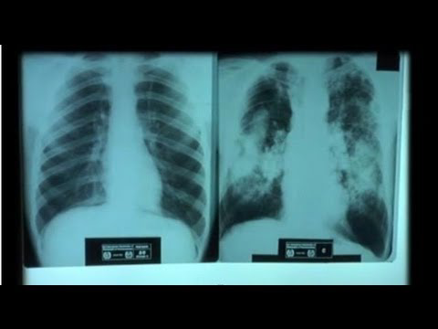 Hqdefault 11123330 jpg