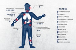 Prolonged exposure to dust has been linked to several types of cancer. Workers in different trades face increased risks of specific illnesses.