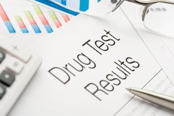 Drug Test Results Getty Images 450300619